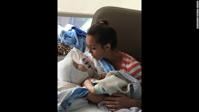 Mom holds separated twin for first time